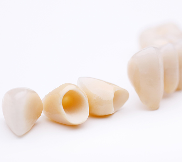 Charleston Dental Crowns and Dental Bridges