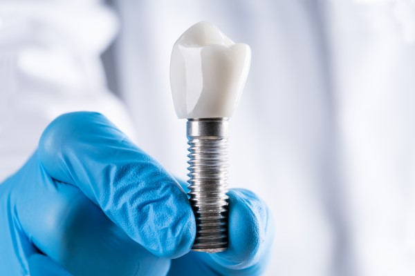 Does Oral Hygiene Change After Getting Dental Implants?