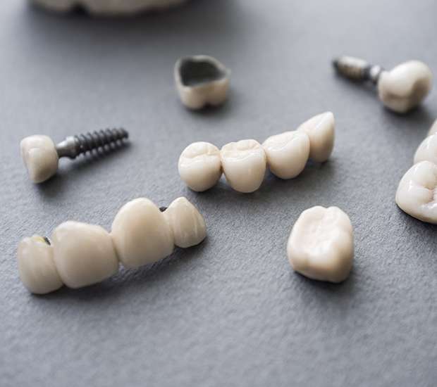 Charleston The Difference Between Dental Implants and Mini Dental Implants