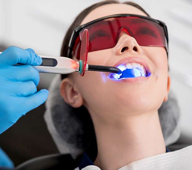 Charleston Professional Teeth Whitening